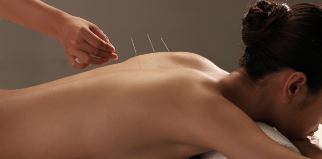 Cum functioneaza acupunctura?