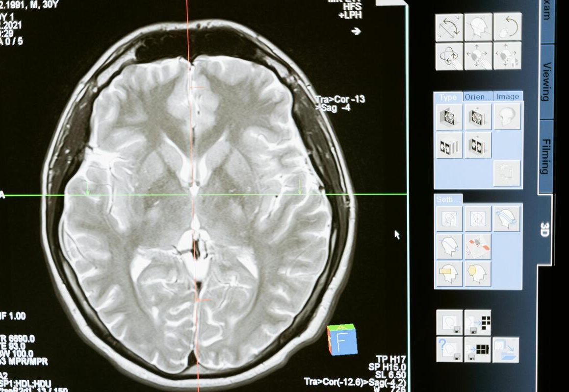 De ce un diagnostic imagistic corect schimbă tot ce urmează în tratamentul tău