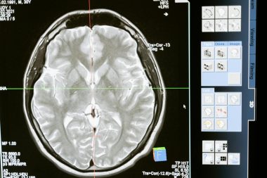 De ce un diagnostic imagistic corect schimbă tot ce urmează în tratamentul tău