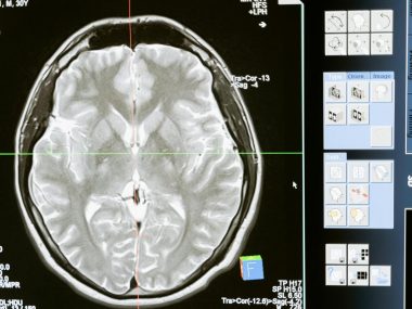 De ce un diagnostic imagistic corect schimbă tot ce urmează în tratamentul tău